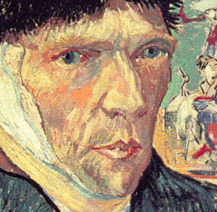 Van Gogh’un kesik kulağı
