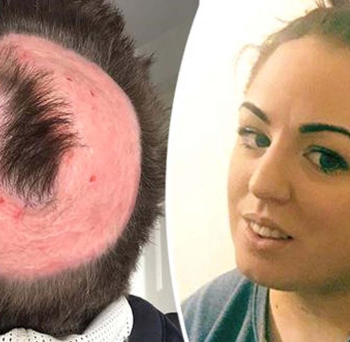 Saç rengini değiştirmek isteyen kadının kafa derisi yandı