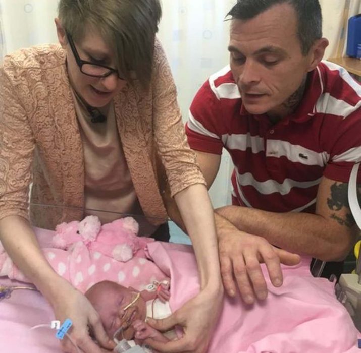 Baby born with heart outside body ‘doing well’