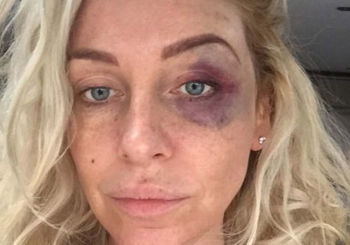 Ünlü televizyon yıldızı Josie Gibson, saldırıya uğradı