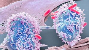 Vücudun kanserli hücreleri ‘yemesini’ sağlayan ilaç üretildi
