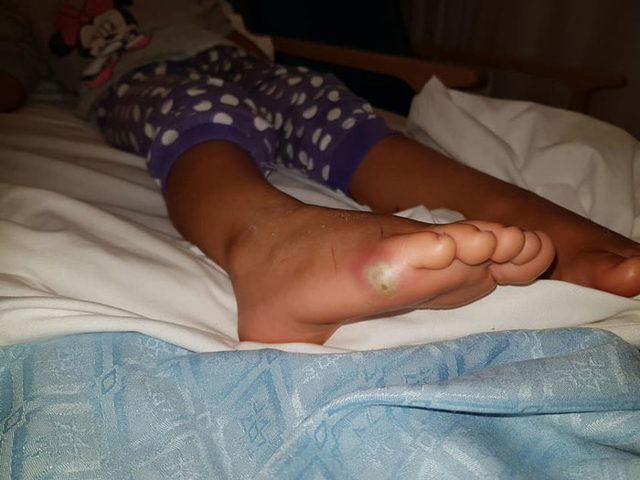 İngiltere’de çıplak ayakla ayakkabı deneyen çocuk hastanelik oldu