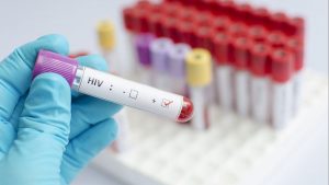 AIDS’le mücadelede çığır açan araştırma: Tedavi virüsün bulaşmasını engelledi