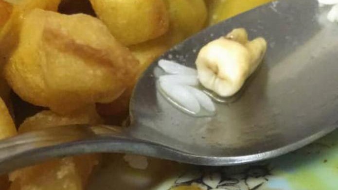 Çin restoranından sipariş verdiği yemeğin içinden diş çıktı
