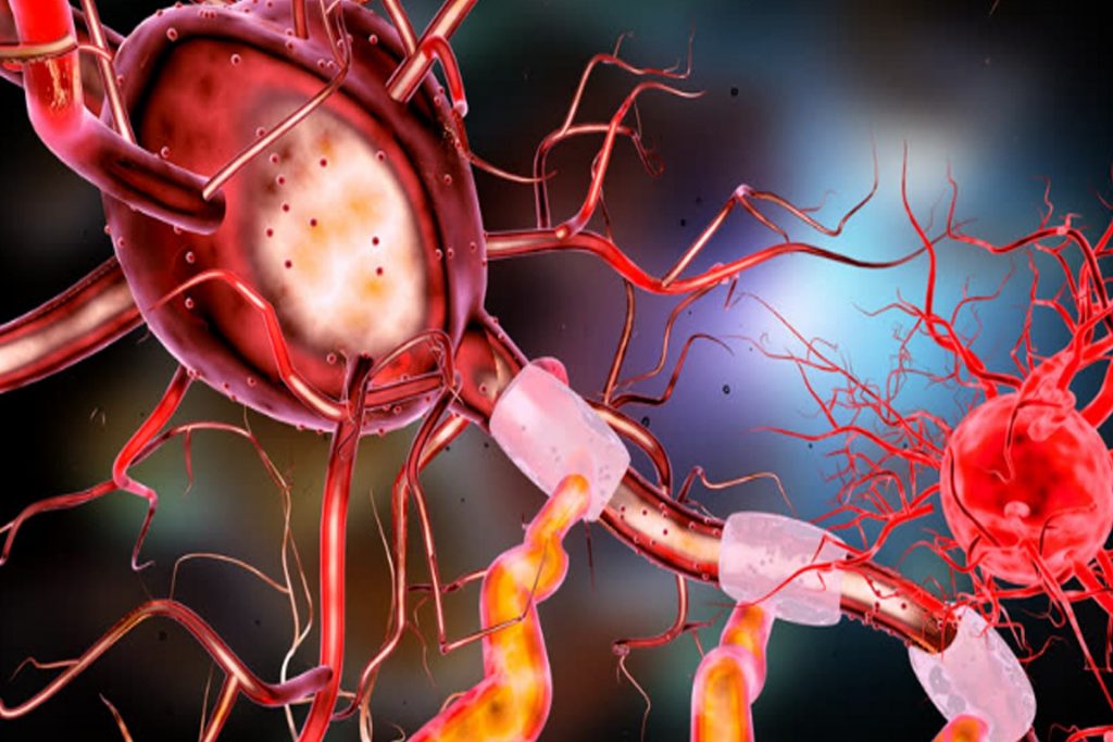 Motor neurone disease ‘linked to cholesterol’