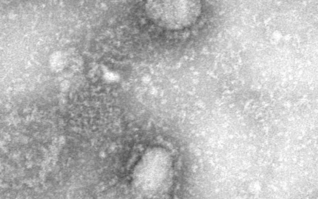 Bilim insanları koronavirüsün ilk mikroskop görüntülerini çekti