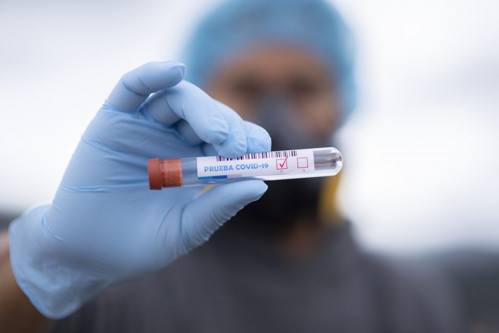 Coronavirus UK: 33,470 new cases and 595 deaths