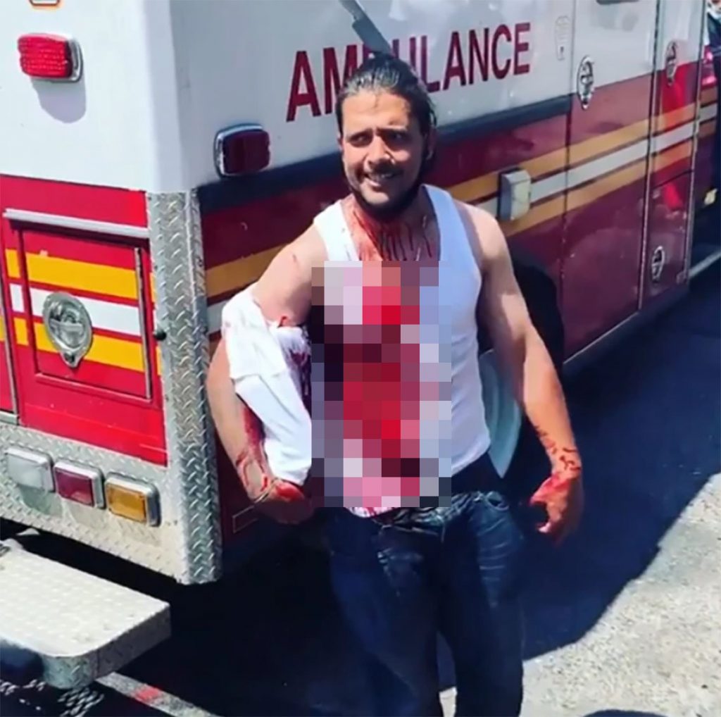 ABD’de saldırıya uğrayan adam kafasına saplanan bıçakla sokağa fırladı