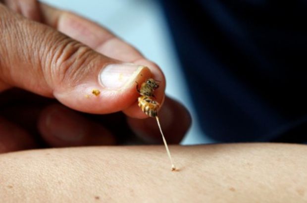 Avusturalyalı bilim insanlarından meme kanserine karşı ‘bal arısı zehiri’