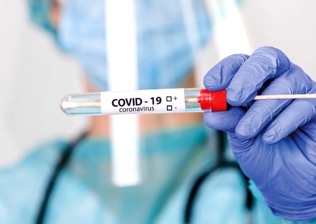 Covid-19 vaka sayısı grip vakalarının 5 katı