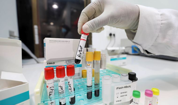 Güney Kore koronavirüs ile mevsimsel gribi aynı anda tespit eden testi onayladı