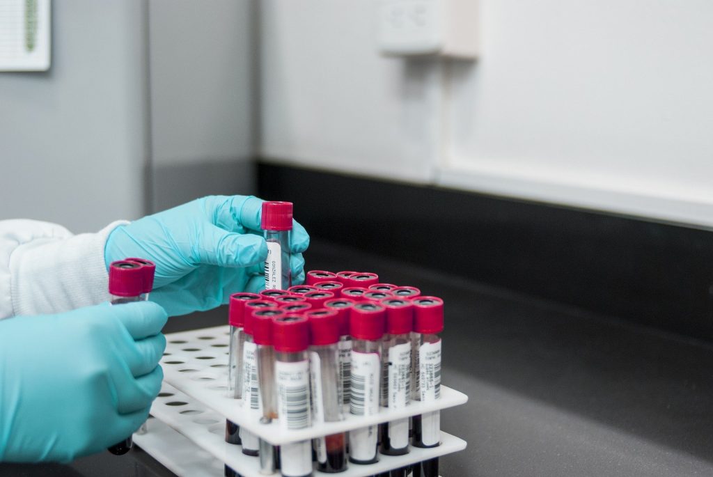 New simple blood test detects cancers among over-50s