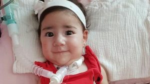 Güney Kıbrıs Asya bebeğin tedavisini üstlenecek