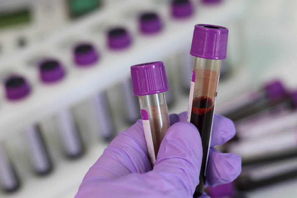 İnsan kanında ilk kez mikroplastik tespit edildi