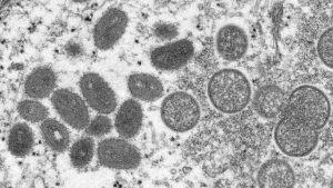 Monkeypox: İngiltere’de 11 vaka daha keşfedildi