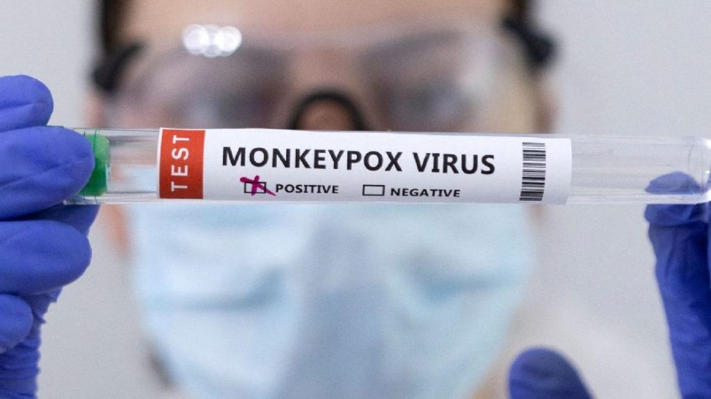 Maymun çiçeği virüsü İngiltere’de kontrol altına alınamıyor