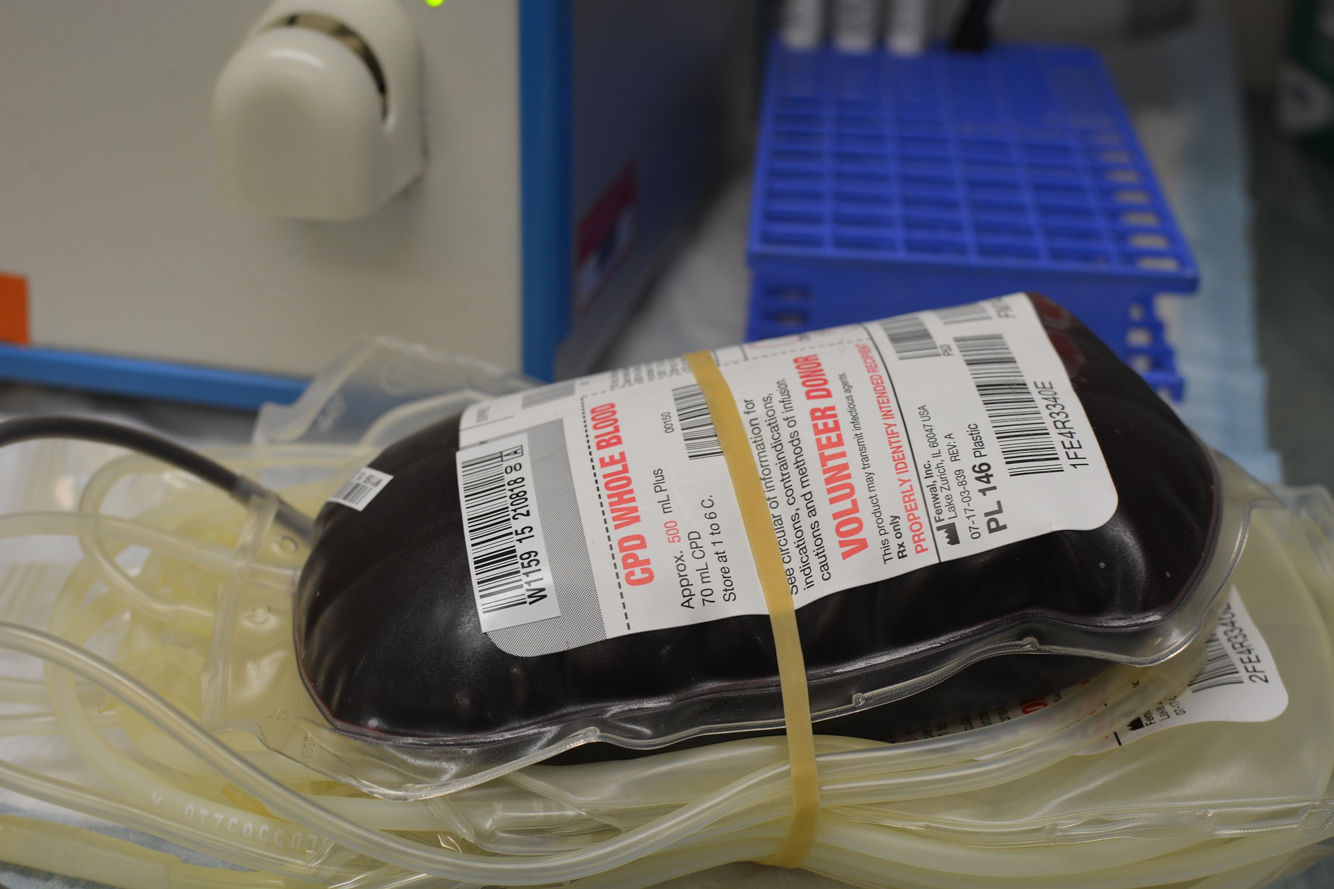 Infected Blood Transfusions Killed 1 820 In UK Study Estimates   2 5 