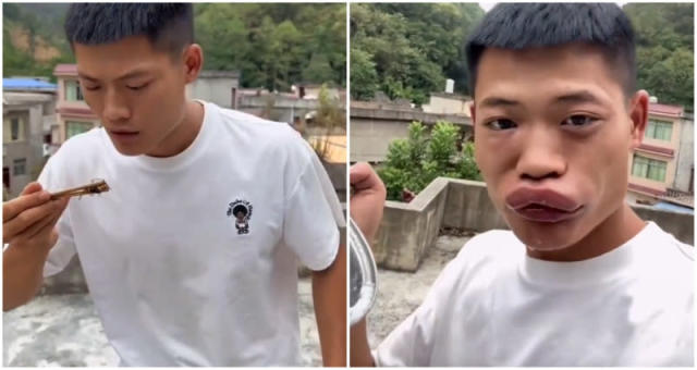 Canlı eşek arısını yiyen Çinlinin dudakları sosyal medyada gündem oldu