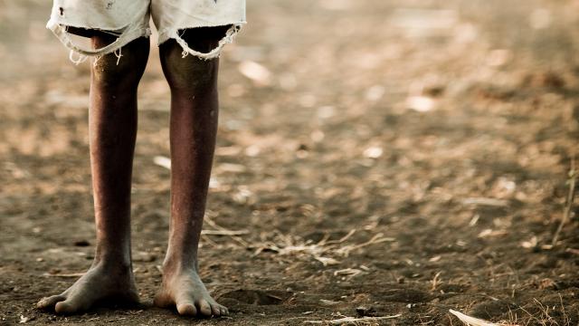 Oxfam: Doğu Afrika’da her 36 saniyede bir kişi açlıktan ölebilir