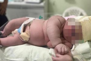 7 kilogram olarak dünyaya gelen bebek herkesi şaşırttı